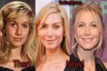 Elizabeth Mitchell Plastic Surgery Before and After